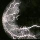 Fluoroangiogram of Amikacin Retinal Toxicity, Macular Capillary Closure Fluoroangiogram of Amikacin Retinal Toxicity, Macular Capillary Closure